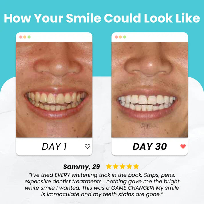 Smart Smile™ Self Brushing Toothbrush
